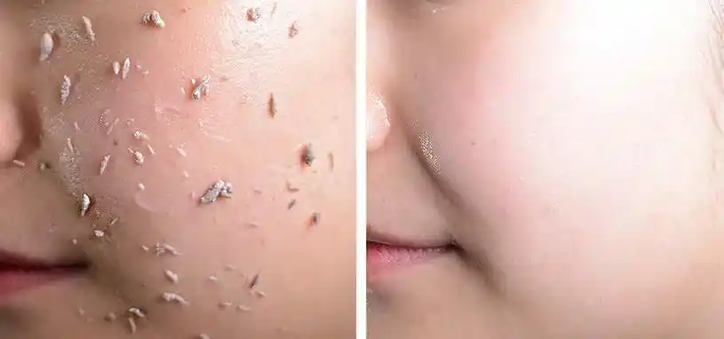 去角质产品搓出来的是不是真的「去角质产品搓出来的是不是真的假的」