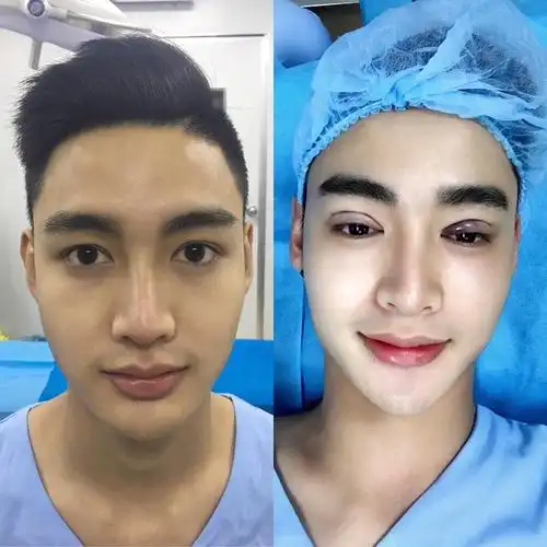 男子因长相自卑整容变帅哥,现自己开多家整容医院还替人做手术