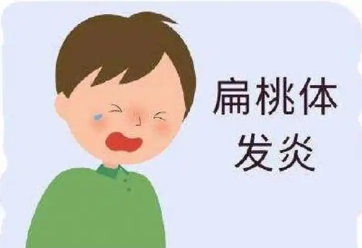 亲身讲述下我儿子闹扁桃体化脓的经历,包括是如何治好的,大家如果看了