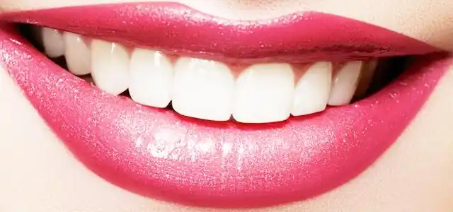 美白剂美白牙齿(皓齿美白)