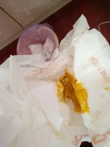 如图请问宝宝的便便正常吗?谢谢