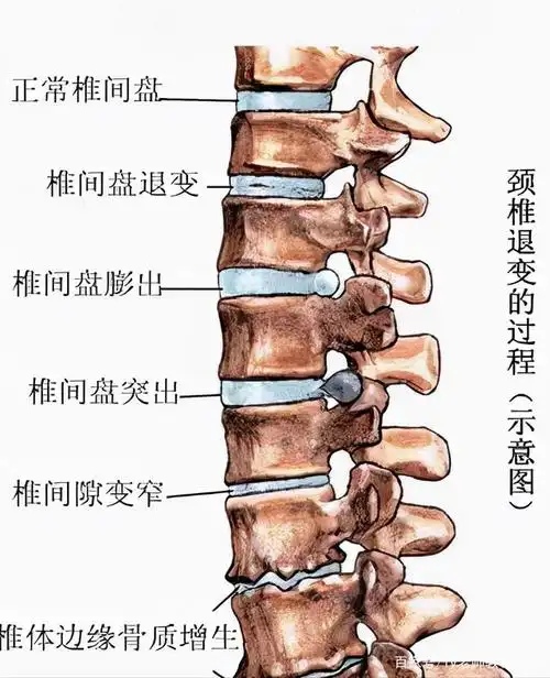 长期伏案,低头玩手机,颈椎疼痛怎么办,5个方法有效缓解改善