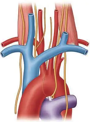 解剖心脏大血管丨主动脉弓分型及常见变异