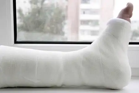 打着石膏的腿图片