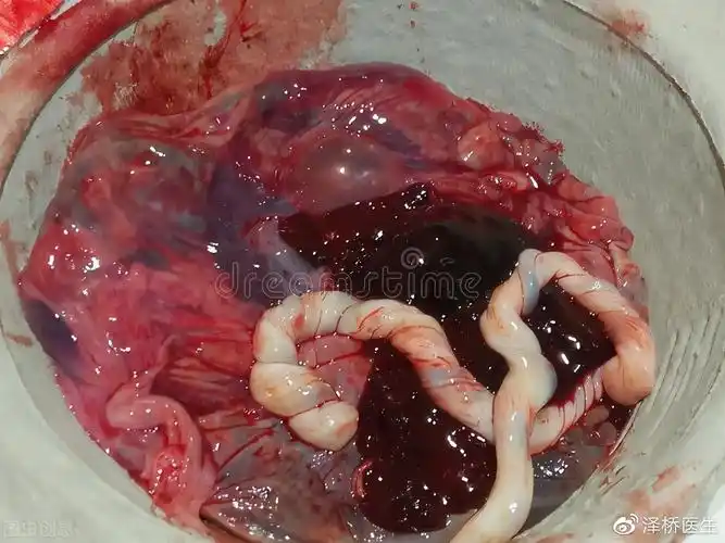 生完孩子胎盘怎么处理吃胎盘真的有保健奇效