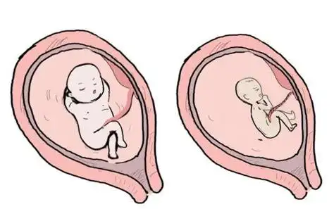 孕20周胎儿器官发育好了吗