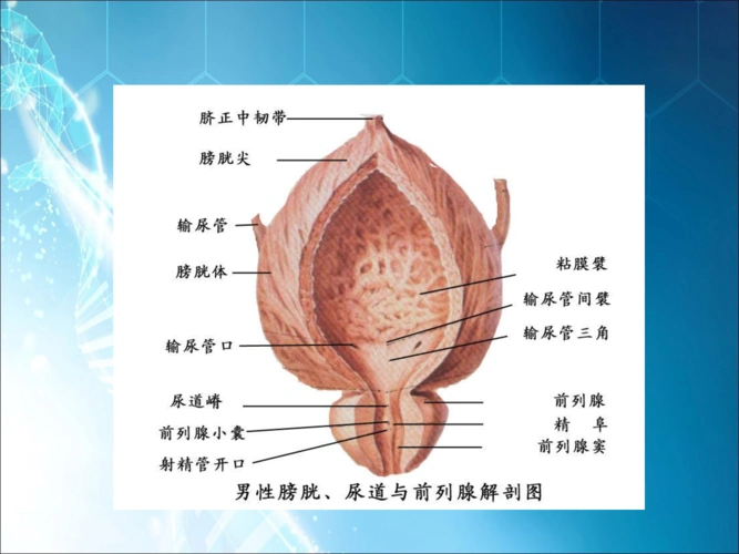 膀胱癌病人的护理ppt课件