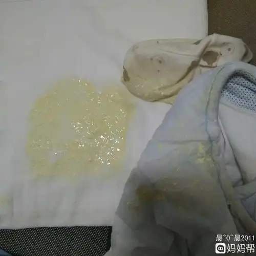 婴儿吐奶严重是怎么回事