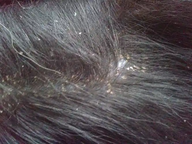 2011-12-26 我家苏牧身上长螨虫了 怎么办啊?