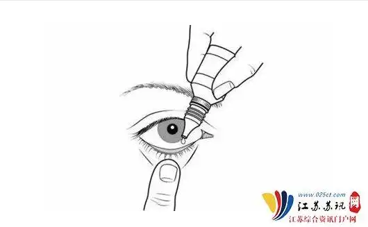 而是要扳开下眼睑,把眼药水滴在眼睛下方的结膜囊上