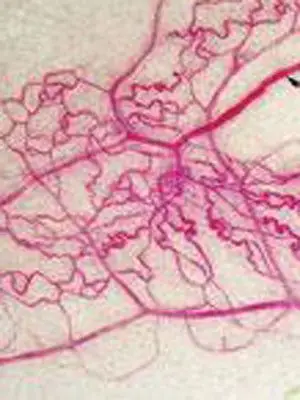 光镜下观察,各种组织和器官中的毛细血管结构相似,但在电镜下,根据内
