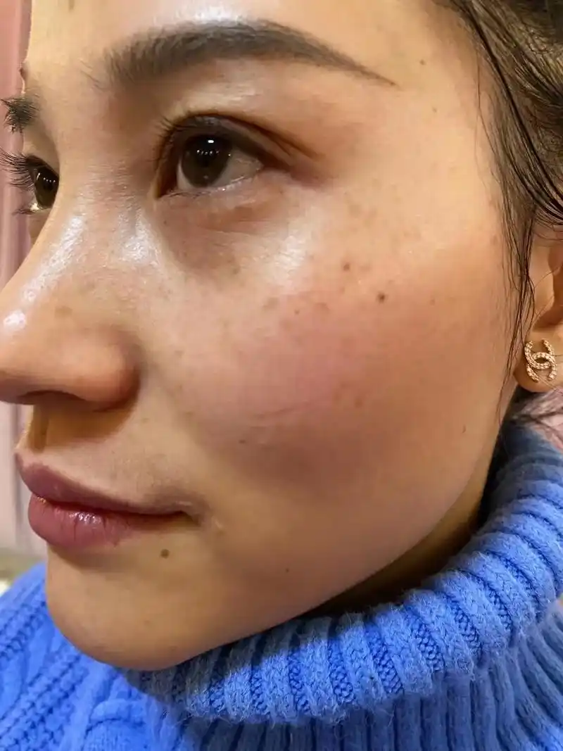 以前的皮肤暗黄,脸上全是斑斑点点的,人也没那么自信,朋友介绍 - 抖音