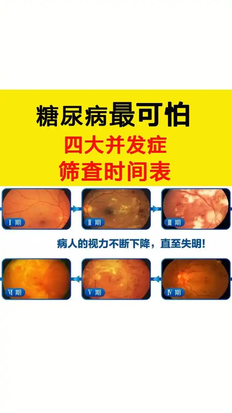 糖尿病不可怕,可怕的是#糖尿病并发症 ,失明,心衰,截肢…早 - 抖音