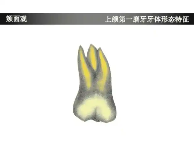 上颌第一磨牙牙体形态简述pptppt