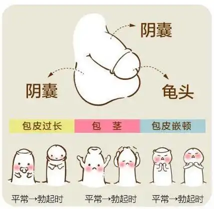 包茎|手术|包皮过长_网易订阅