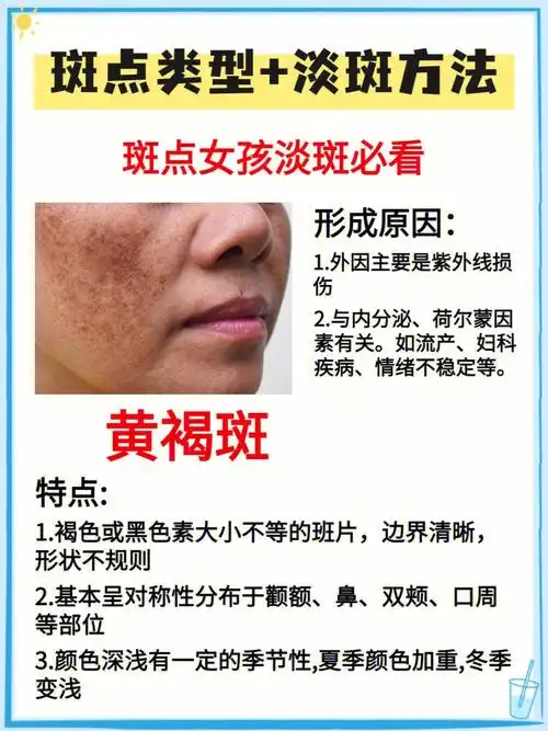 斑点的特点和成因78看看你有没有中招的