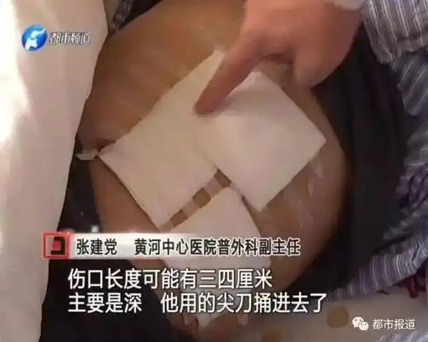 【暖新闻】被刀捅伤,肠子外露 郑州62岁保安忍痛追歹徒