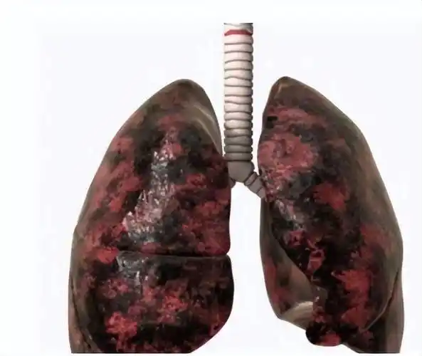 多少岁戒烟肺部更健康建议这个年纪最好