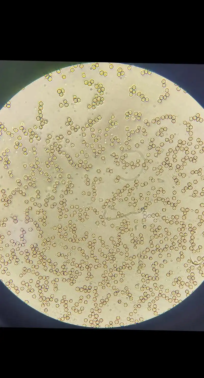 显微镜下的世界 #看血细胞 - 抖音