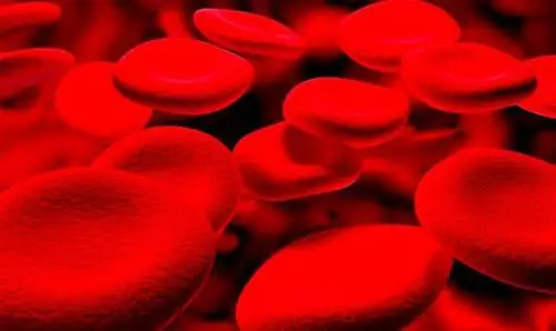 【doc】脓毒症患儿的持续血液净化治疗22例分析-学路网-学习路上 有我