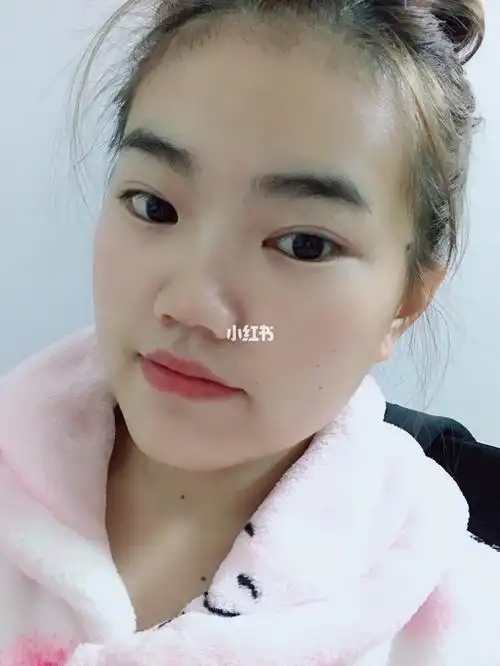 五官扁平一直让我很自卑01有同款脸的宝宝吗