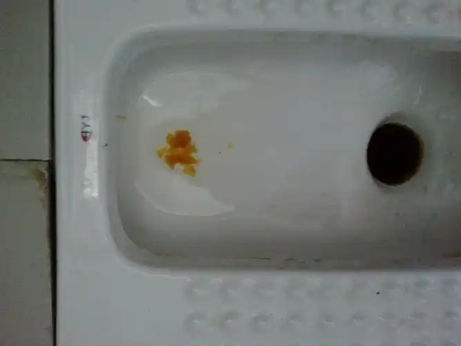 拉出来的大便时这个样子的,是怎么回事?,急