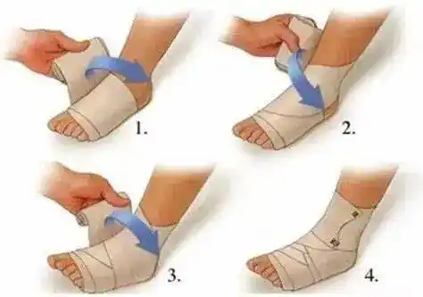 包扎方法可以使用8字包扎法,亲测好用.