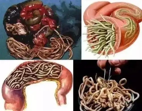 寄生虫长什么样子图片人体有多少种寄生虫