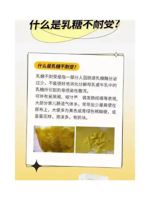 67发现现在新手宝妈有时候不懂以为67母乳喂养大便次数多是正常