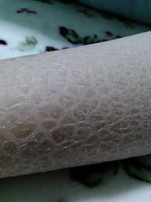 小孩子皮肤全身都是粗糙的鱼鳞状是什么病?该怎么治疗