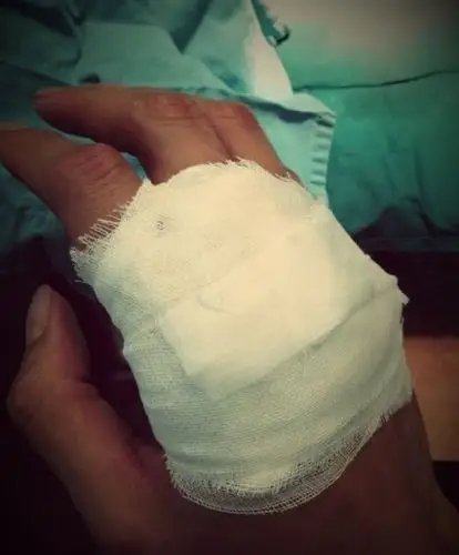 广东距决赛仅差一步 右手缝7针阿联想带伤出战