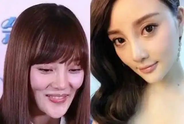 整容痕迹明显的几位女明星,却"死活"不承认自己做过整形