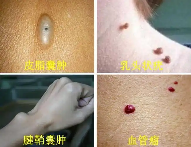 福州患儿来常德就医这家医院门诊手术有绝活