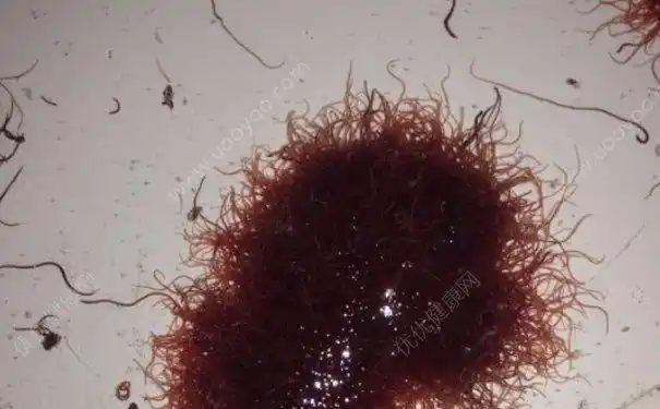 红线虫有什么用处 红线虫有什么价值 红线虫的经济价值