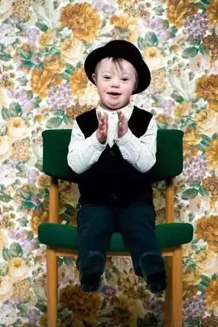 每20分钟就有1个唐宝宝出生请每一位准妈妈重视唐氏筛查