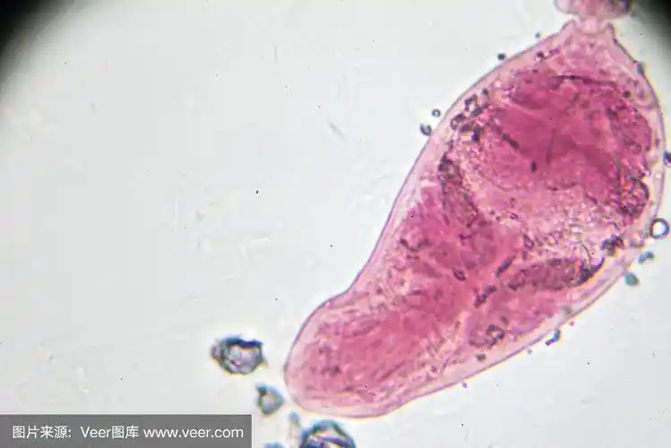 日本血吸虫尾蚴光镜下观察