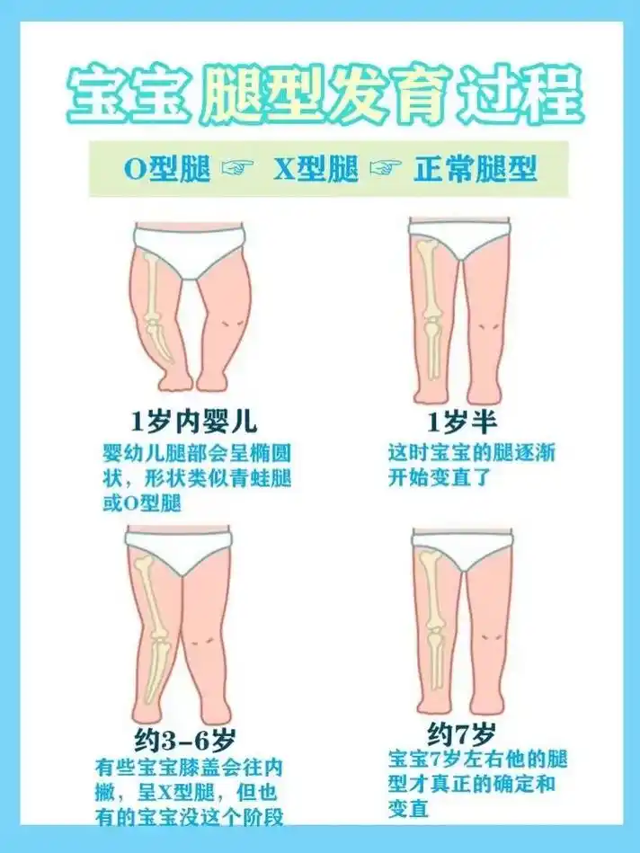 宝宝o型腿是正常的!宝宝腿部发育过程.#图文扶持计划入口  - 抖音