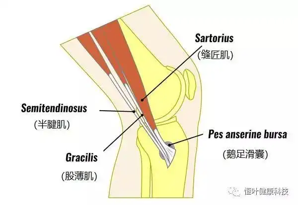 鹅足腱滑囊炎你知道多少?