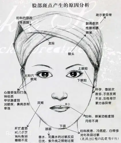 翌芙莱分享:面部长斑一定要重视!教你从色斑的位置看健康隐患