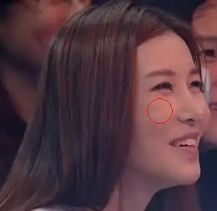 眼睛下边的肉坑叫什么,也是酒窝吗?