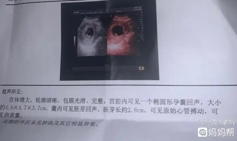 手常常感觉很干100%生男孩的症状9肚子形状象篮球10会变得很黑;怀孕的