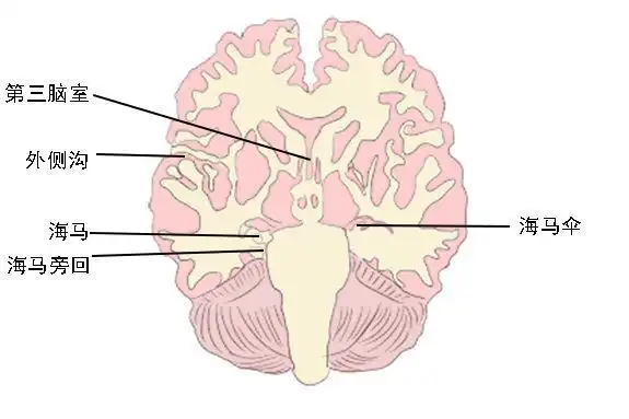 大脑冠状面解剖图
