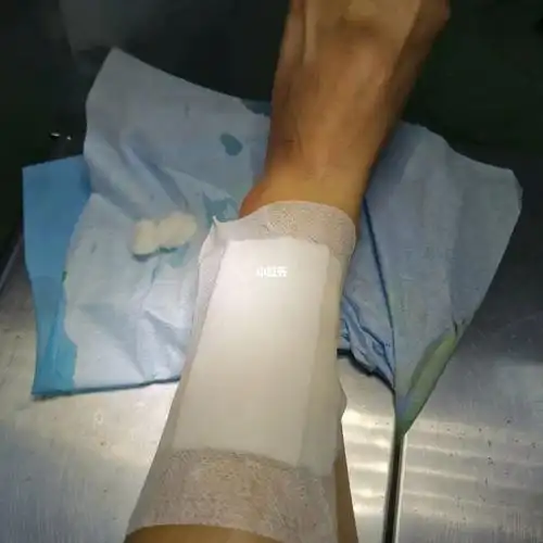 记录第一次缝针记录