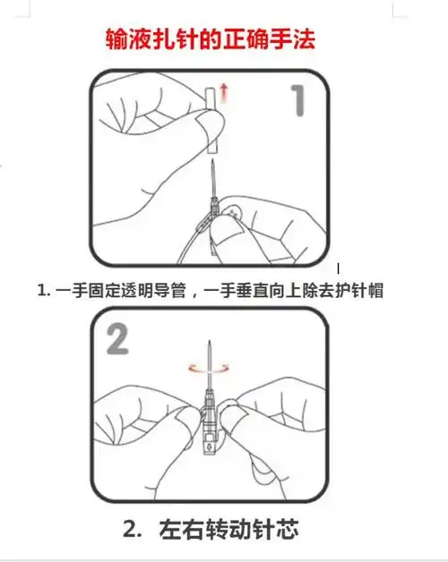 输液扎针技巧示范再也不怕别人说技术不到位了