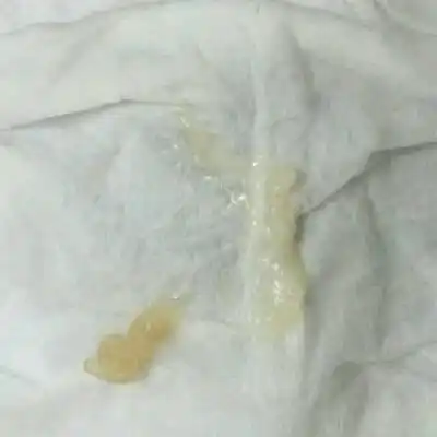 我孕九周今天下面流了透明固体状东西,是啥啊?