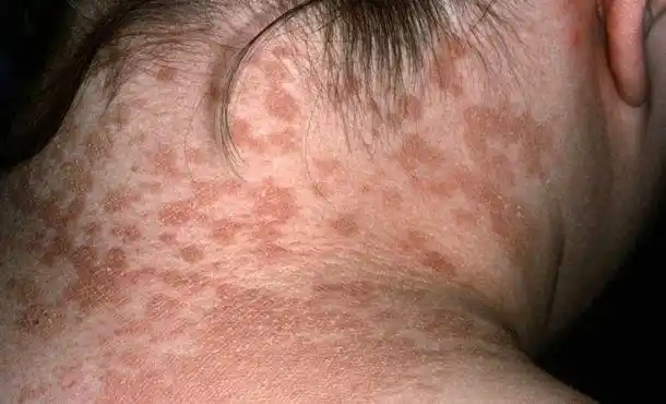 注意,新生宝宝脖子易出现这4种问题,爸妈要当心