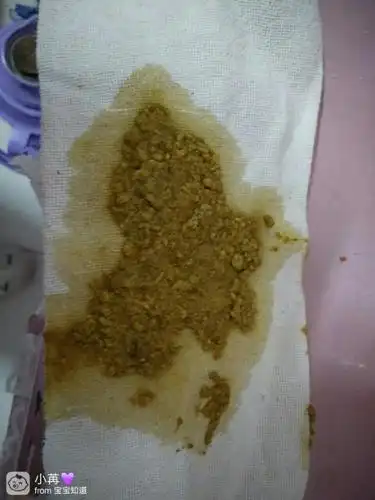 新生儿出生五天,拉的奶瓣,正常吗?