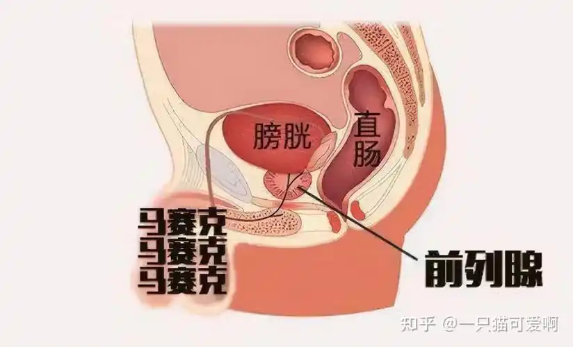 前列腺是男人身体中一个生殖附属器官,能够帮助排出前列腺液促进精子