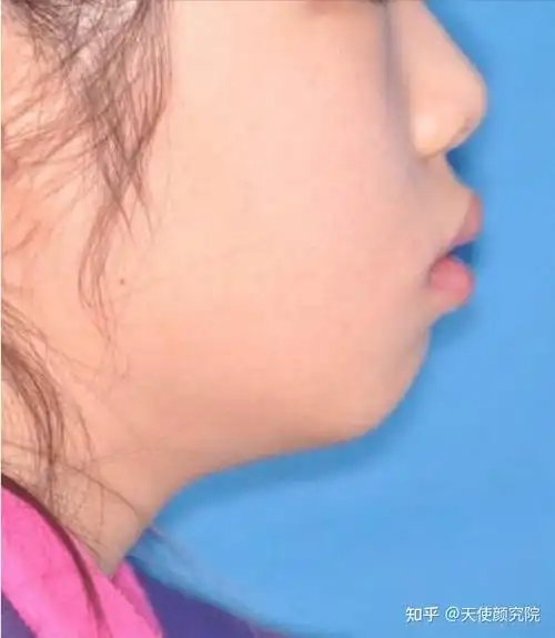 周也张婧仪同框双双被嘲为什么小花们越来越龅牙