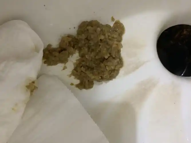 这个大便颜色正常吗